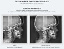 Cargar imagen en el visor de la galería, Rayos X Panoramicos